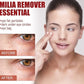Smooth Milia Remover Serum