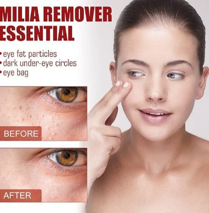 Smooth Milia Remover Serum