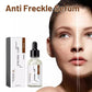 Anti Freckle Serum