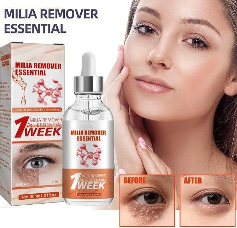 Smooth Milia Remover Serum